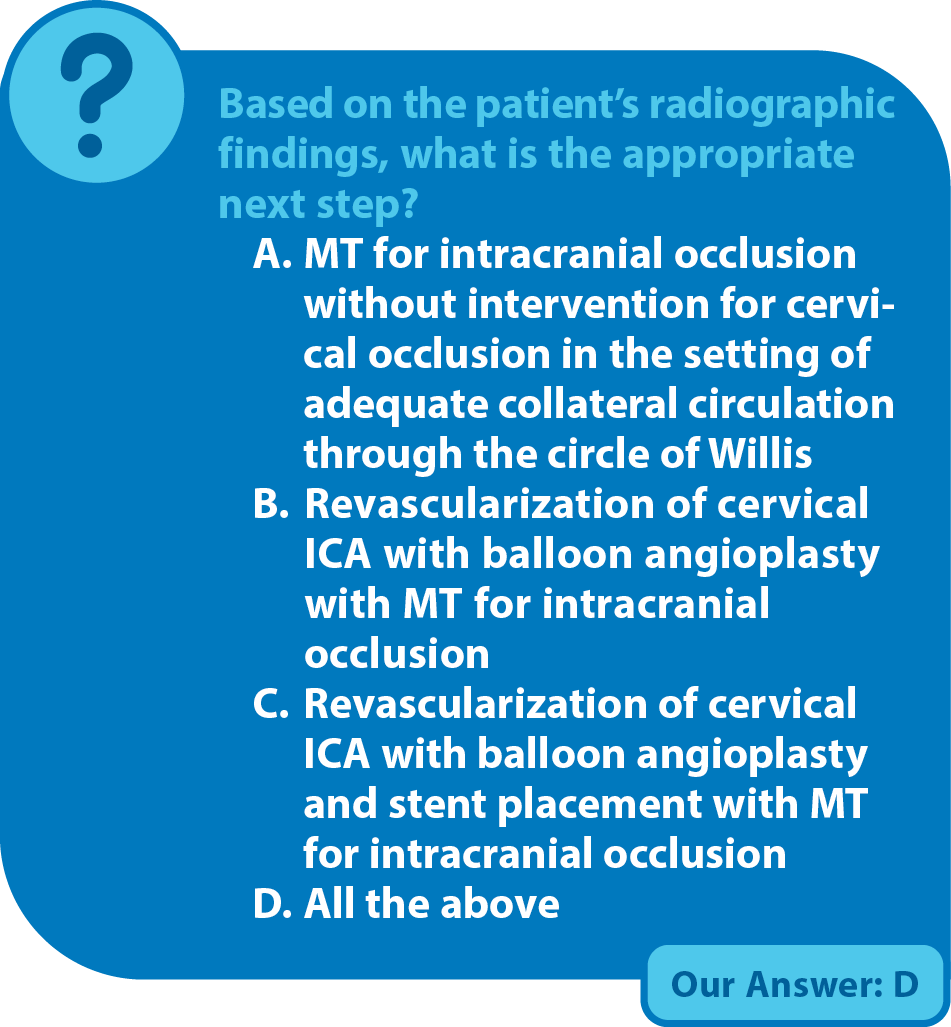 Acute Ischemic Stroke With Tandem Occlusion Requiring Cervical And ...